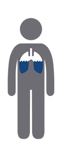 ADHF figure congestion