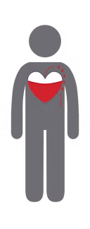 adhf-figure-heartfailure-grey